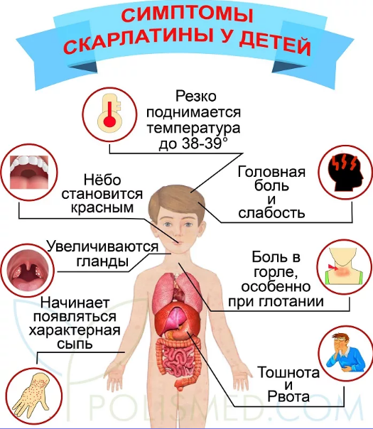 Симптомы скарлатины у детей - врач назвала основные признаки | РБК Украина